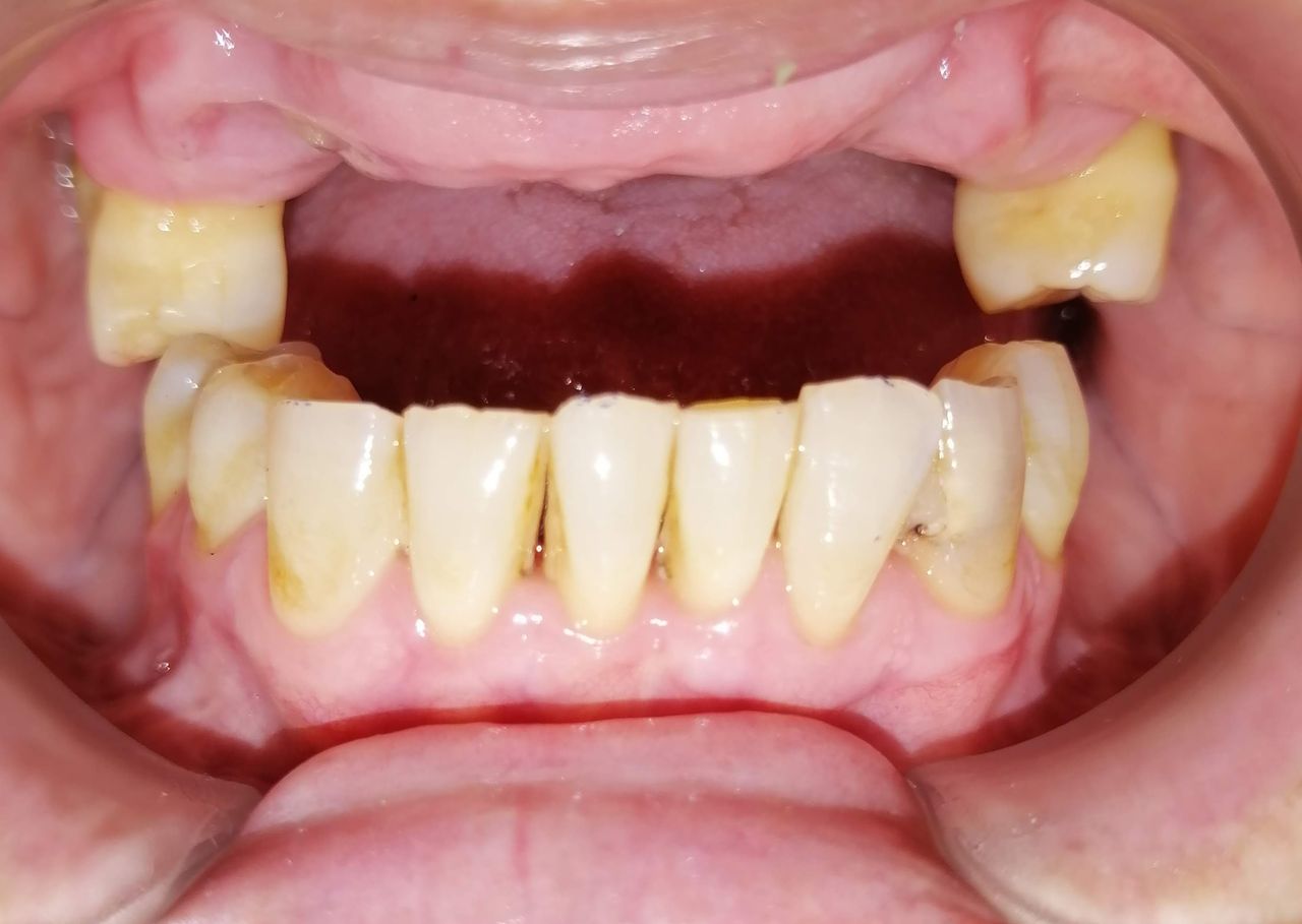 Yaneth Gutiérrez Sánchez-10