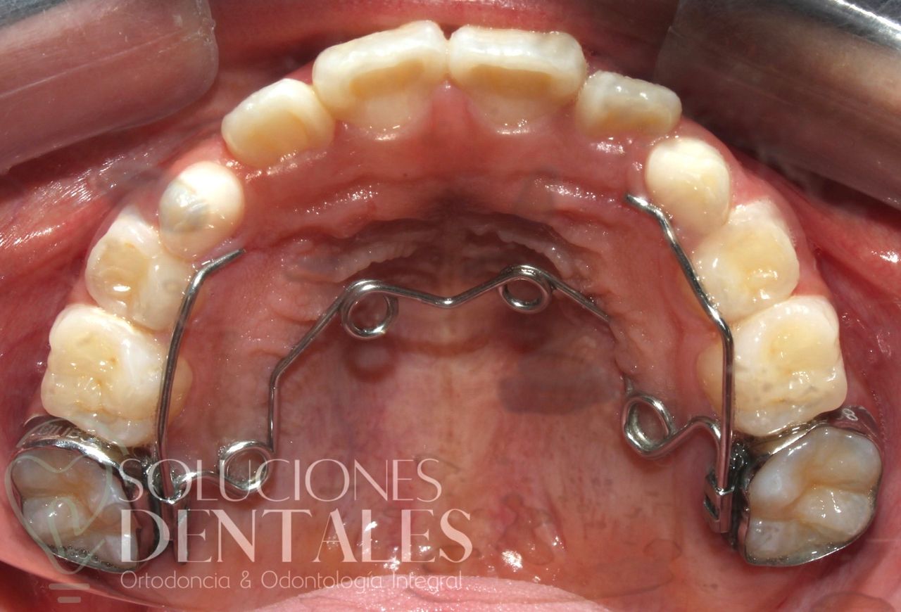 Sonia Larissa Riquelme Cuellar-6