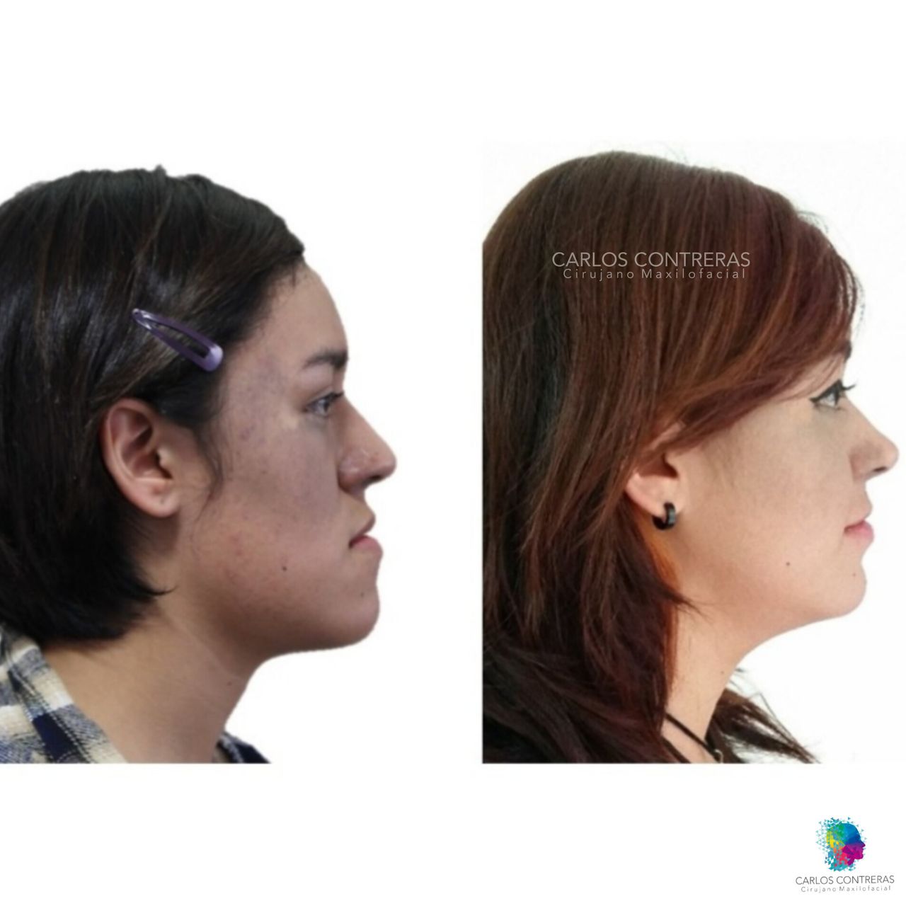 Carlos Ernesto Contreras Castellanos-2