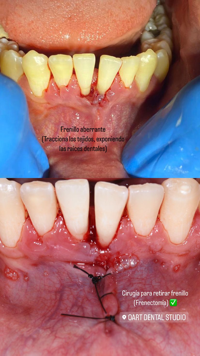 Cinthya Arelí Hernández Ramírez-5