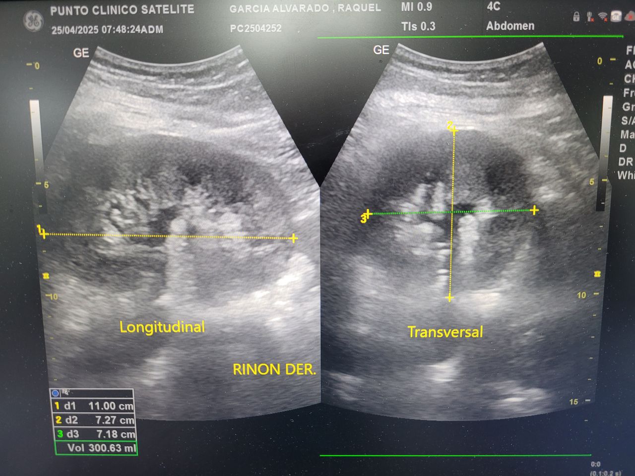 Einar Arik Nuñez Sanchez-6