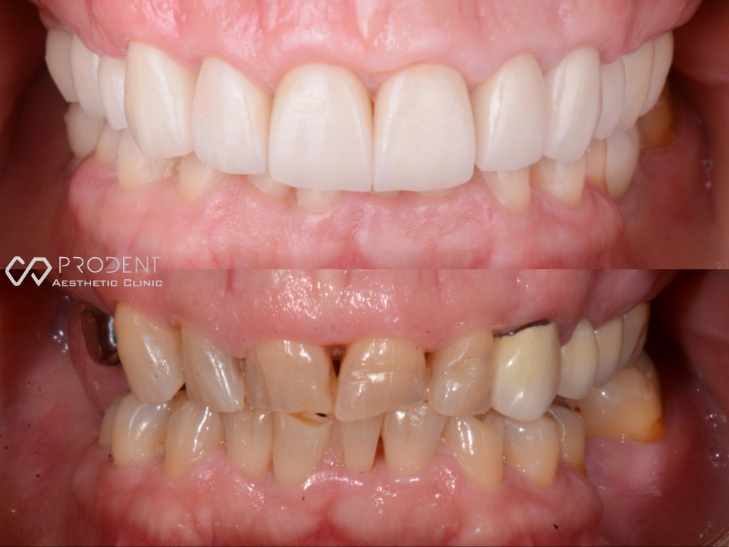 Ramiro Ivan Pérez Murillo-30