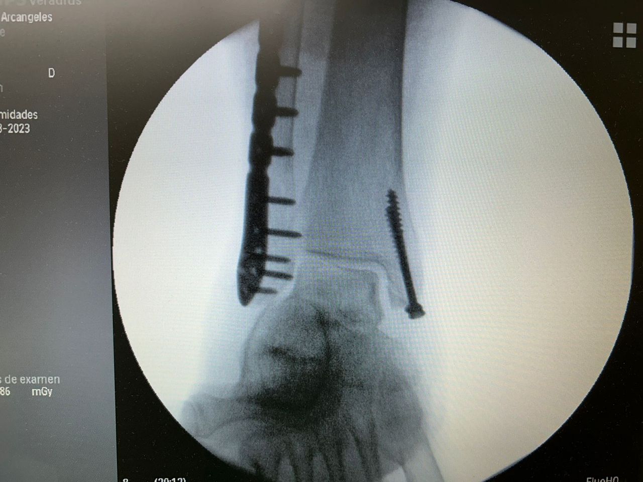 Alberto Lorenzo Cortés-6