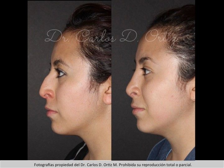 Carlos David Ortiz Moreno-58