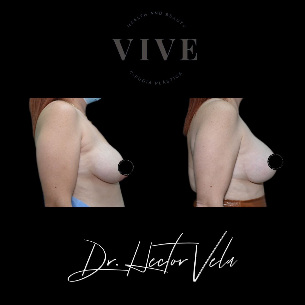 Héctor Eduardo Vela Cardona-65