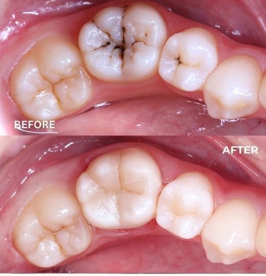 Luis Ángel Ortiz López-37