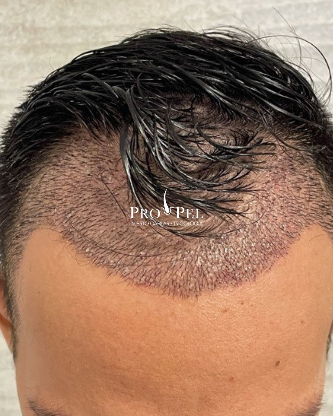 Karla Vanessa Becerra-13