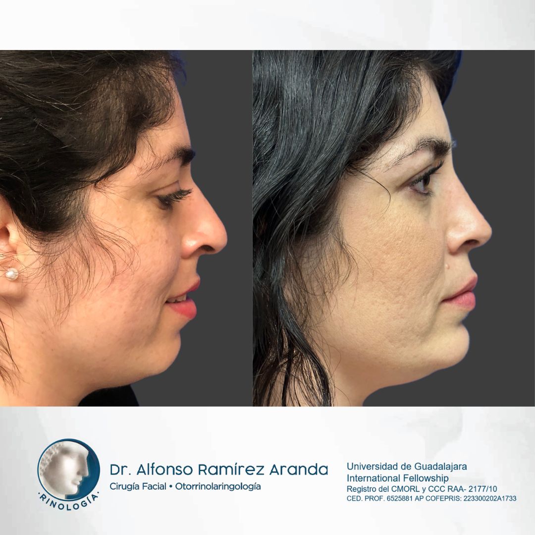 Alfonso Ramírez Aranda-34