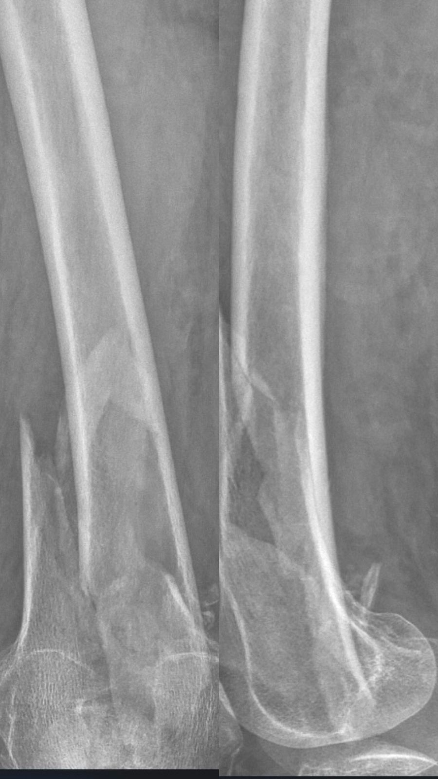 Carlos Humberto Vera Torres-5