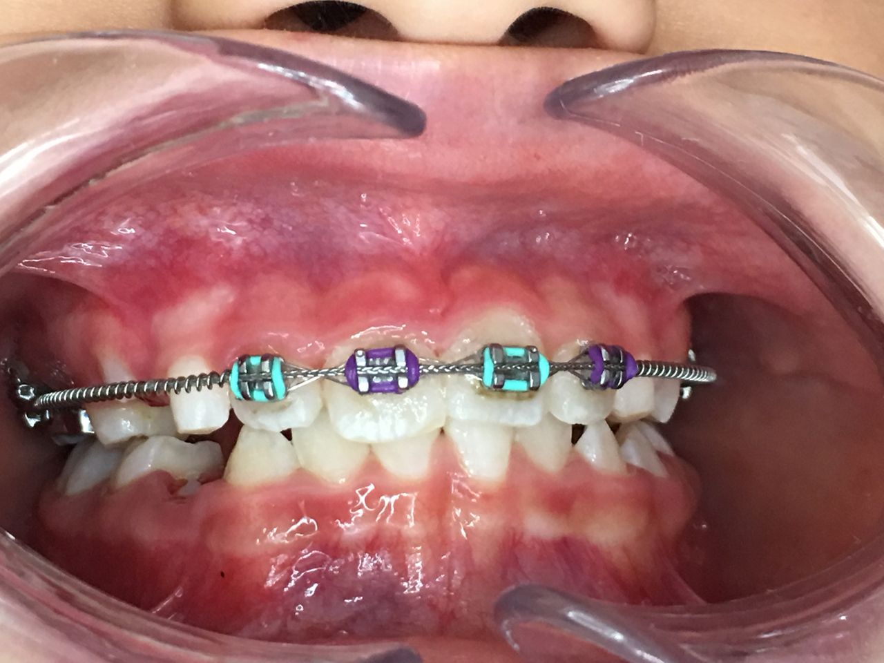 Patricia Rizo Palos-8