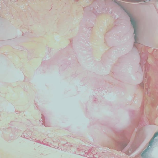 Iván Nájera Ayuso-12