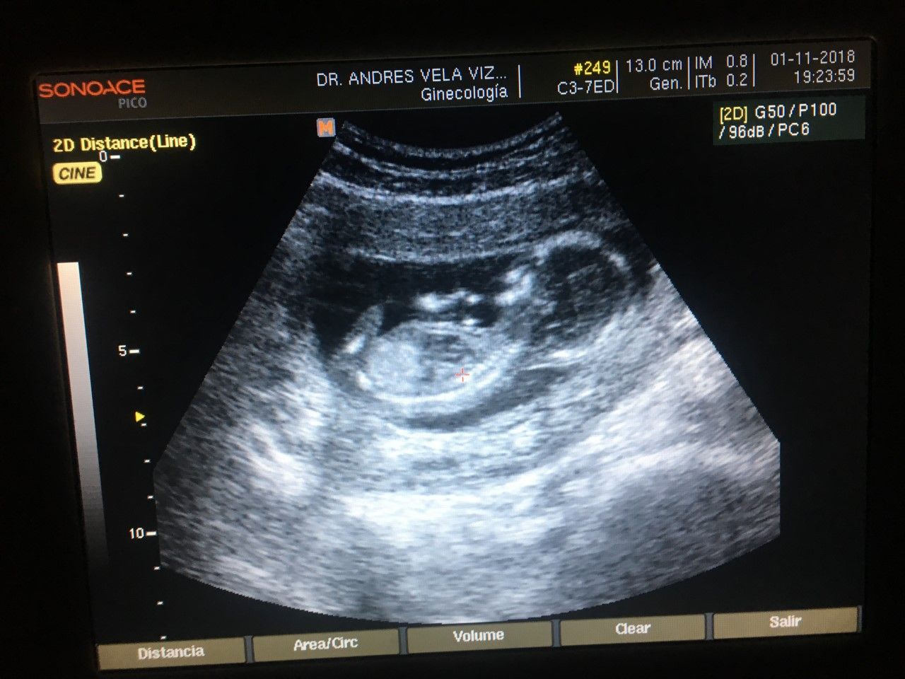 Andrés Vicente Vela Vizuet-31