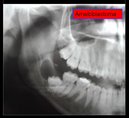 Diana Araceli Dávila Hernández-31