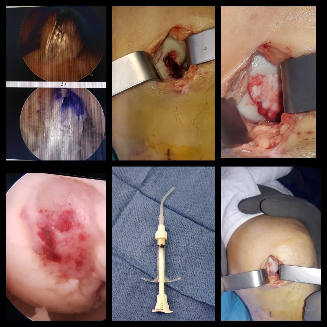 José Antonio Algarín Reyes-17