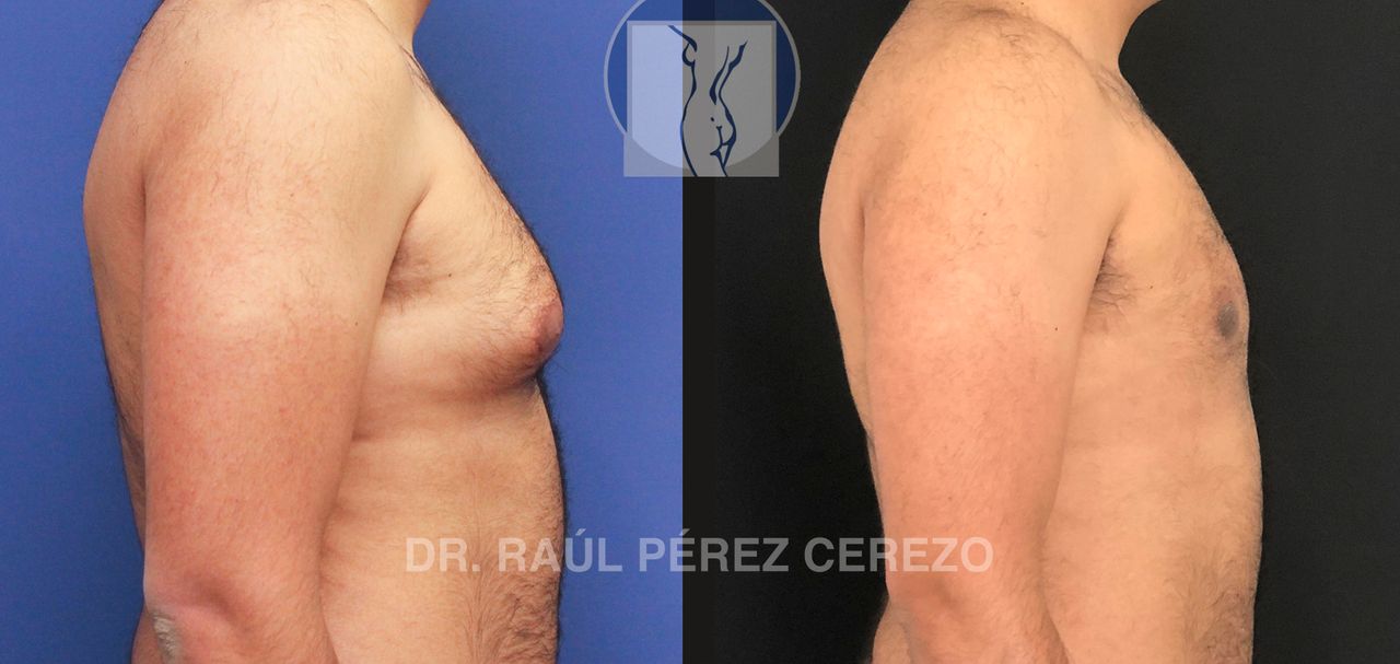 Raúl Pérez Cerezo-37