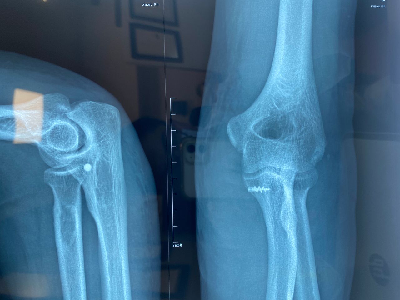 Carlos Humberto Vera Torres-11