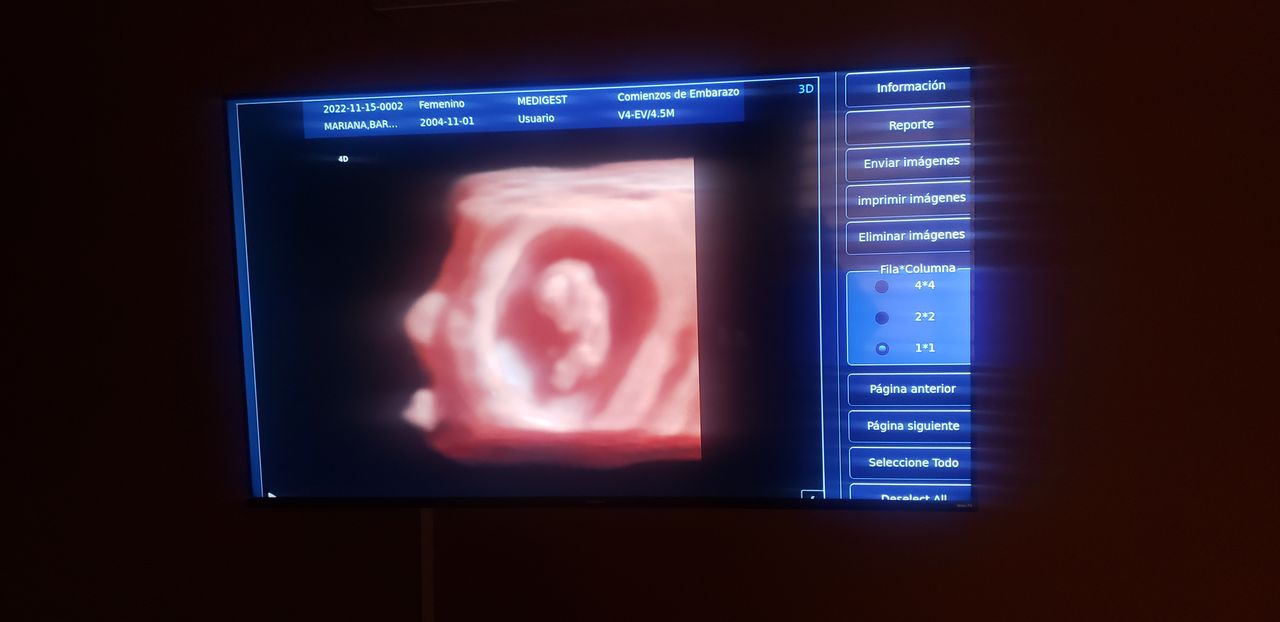 Marco Aurelio Corona Hernandez-26