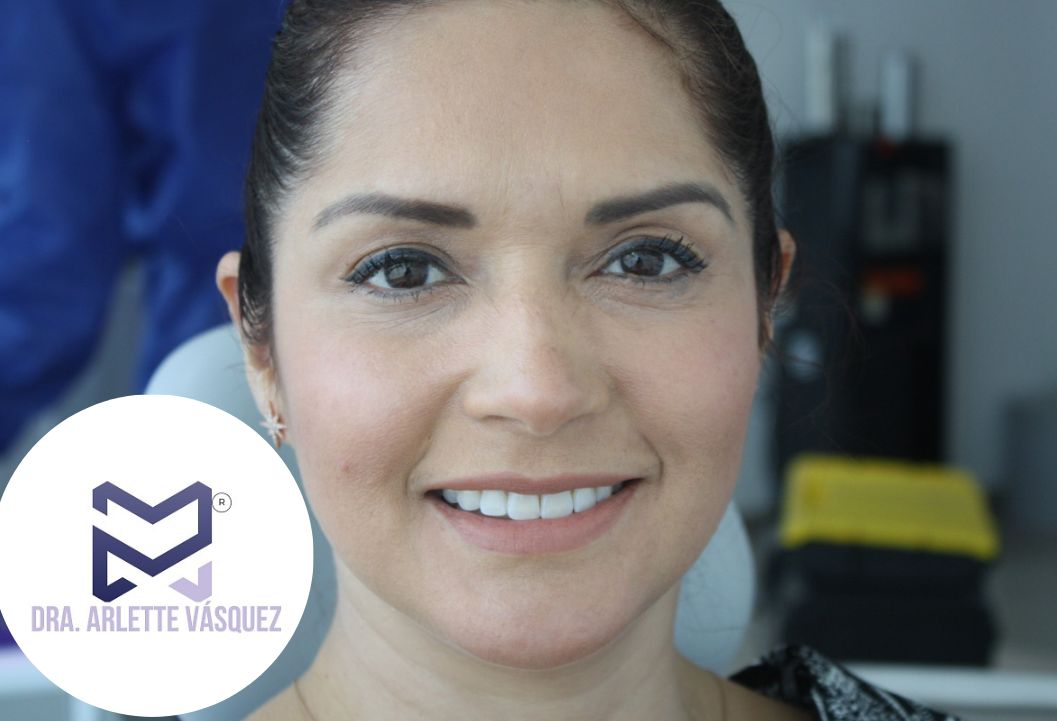 Arlette Vásquez Garza-4