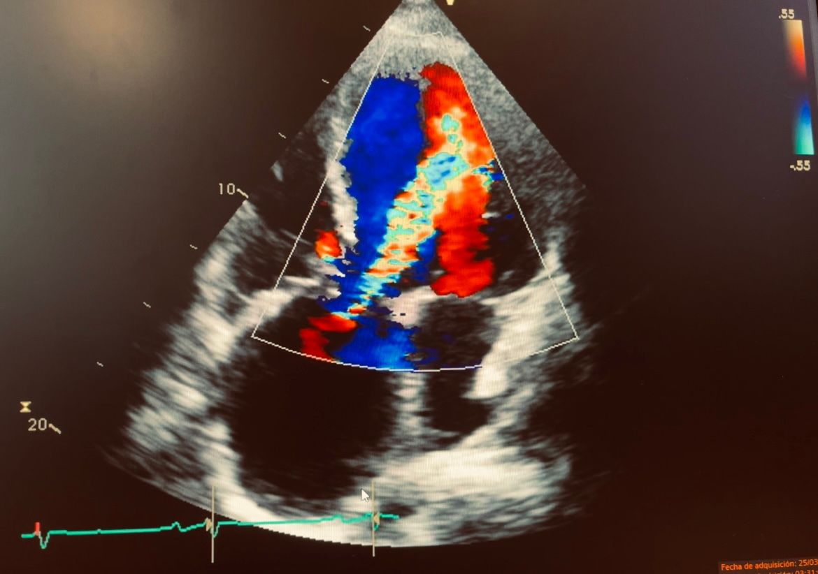 Francisco Javier Reyes Alvarez-0