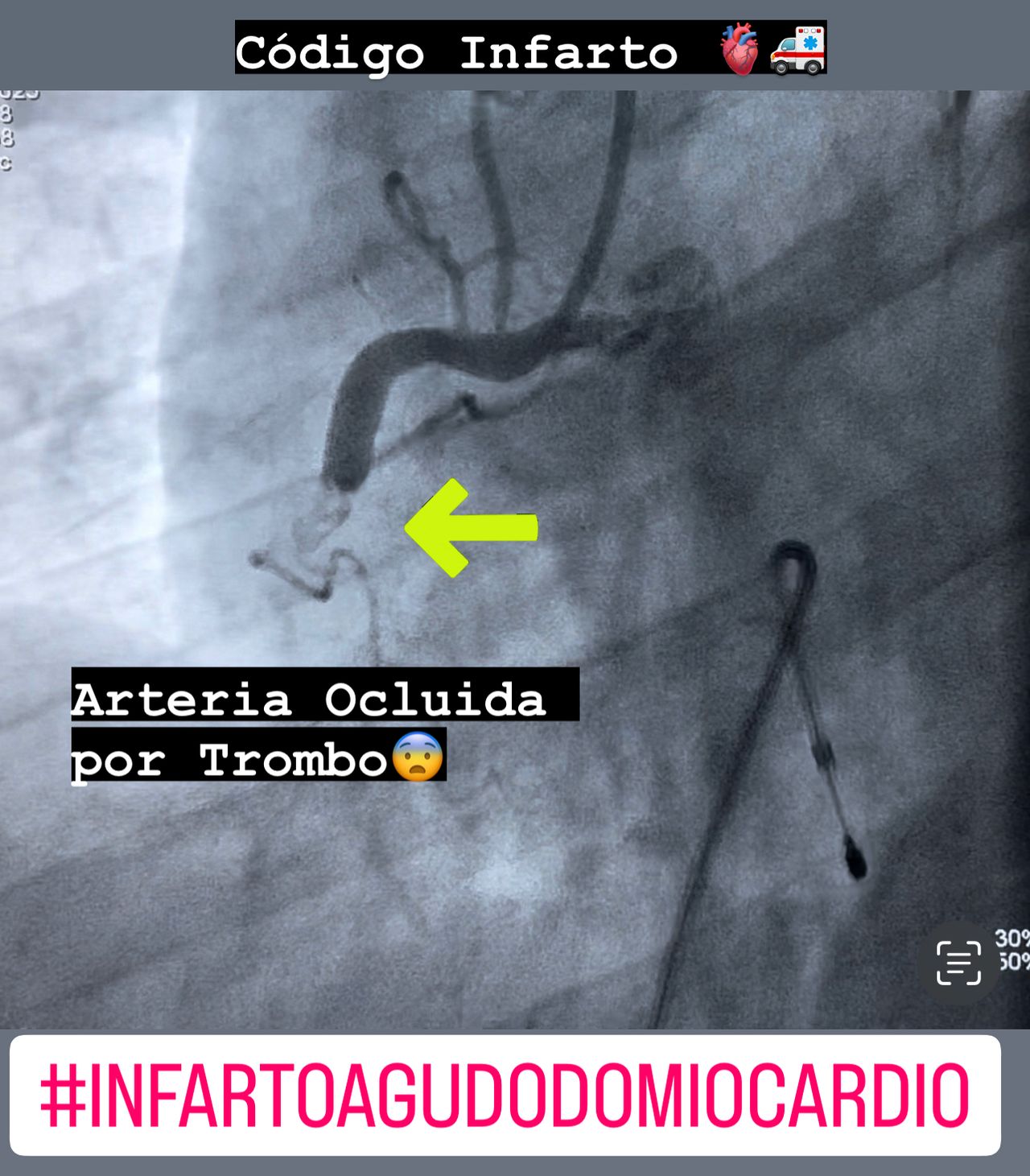 Abdón Ávila Chávez-24