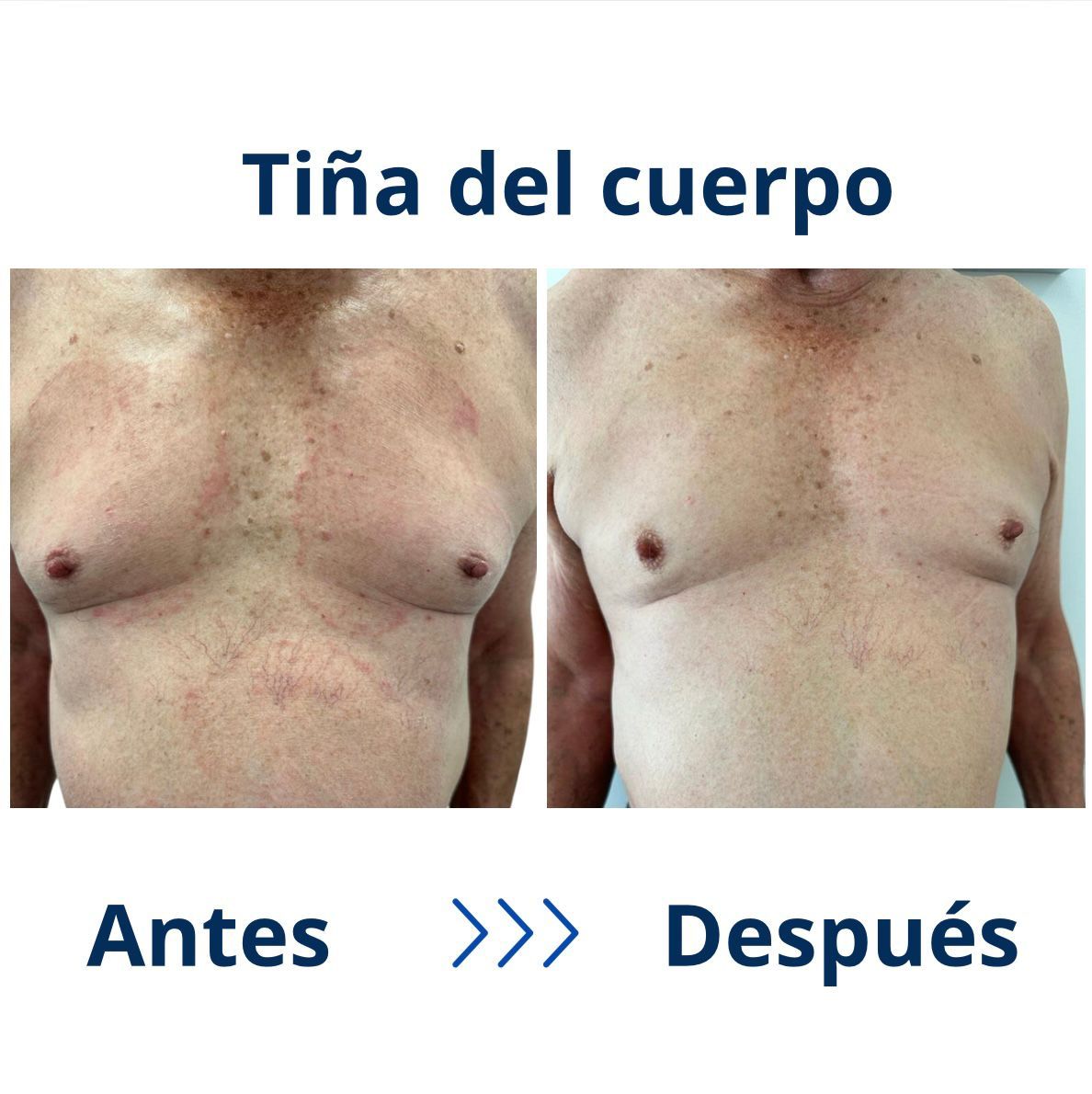 Itzel Anayn Flores Reyes-43