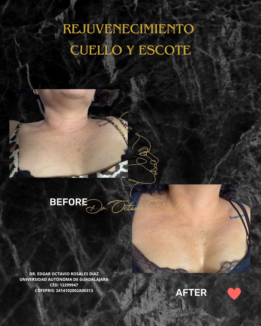 Edgar Octavio Rosales Diaz-24