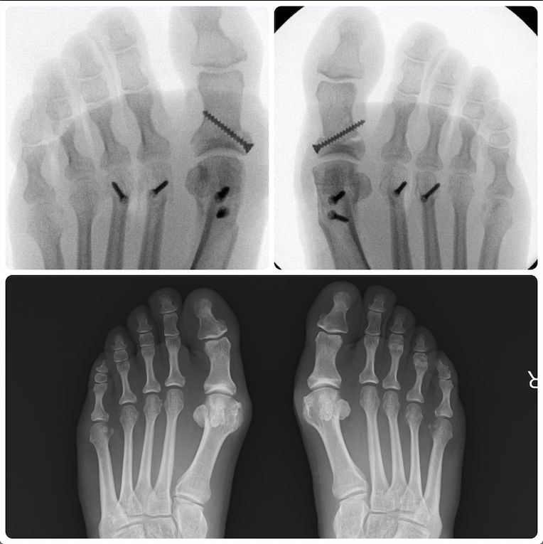 Luis Iram Lozano Parra-11