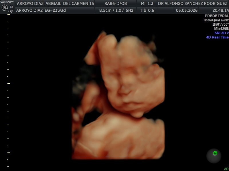 Alfonso Sanchez Rodriguez-55