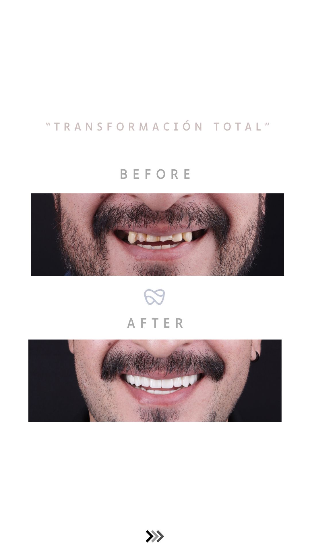 Erick Perea Santillán-7