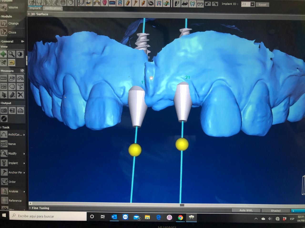 José Alberto Martínez Basulto-15