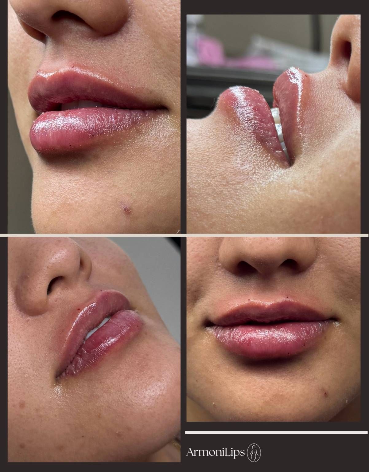 Josehlyn Martínez Carrillo-4