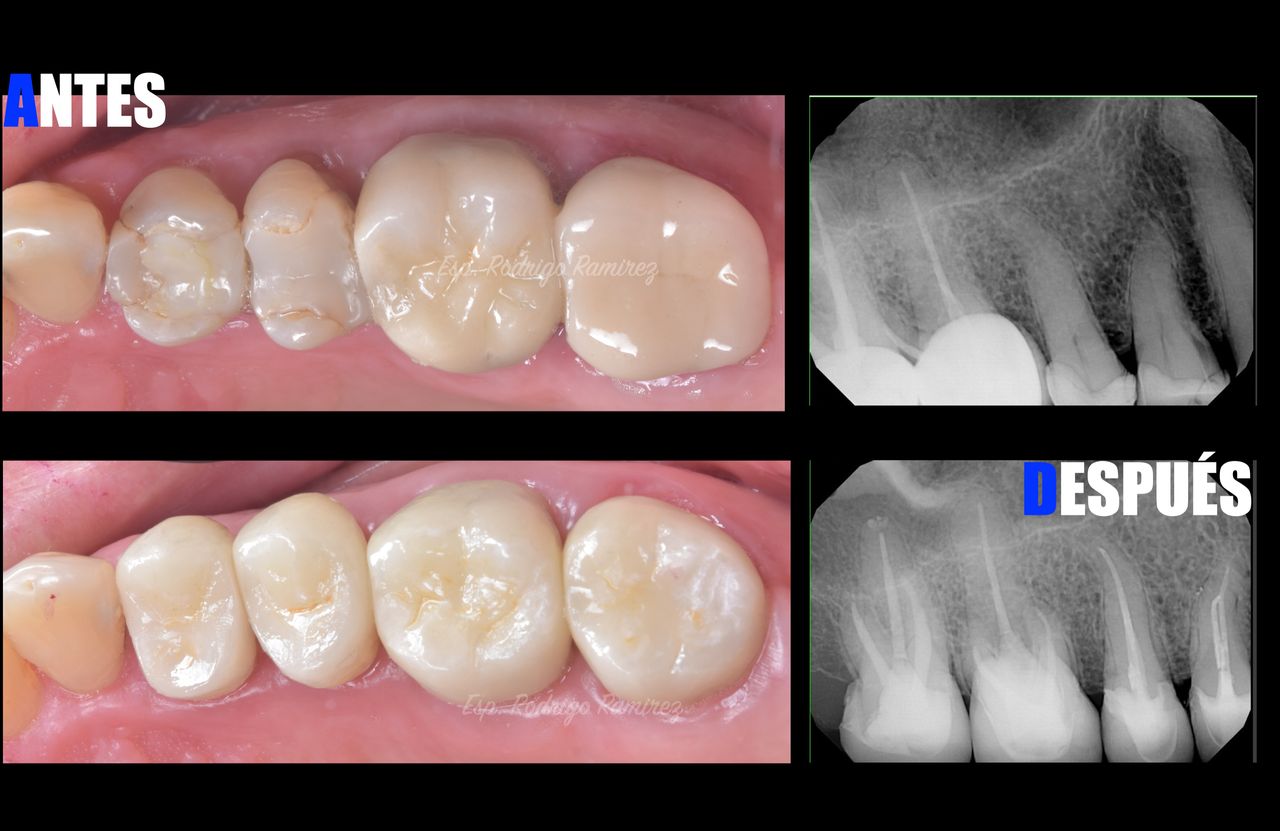Rodrigo Ramirez Olivares-0