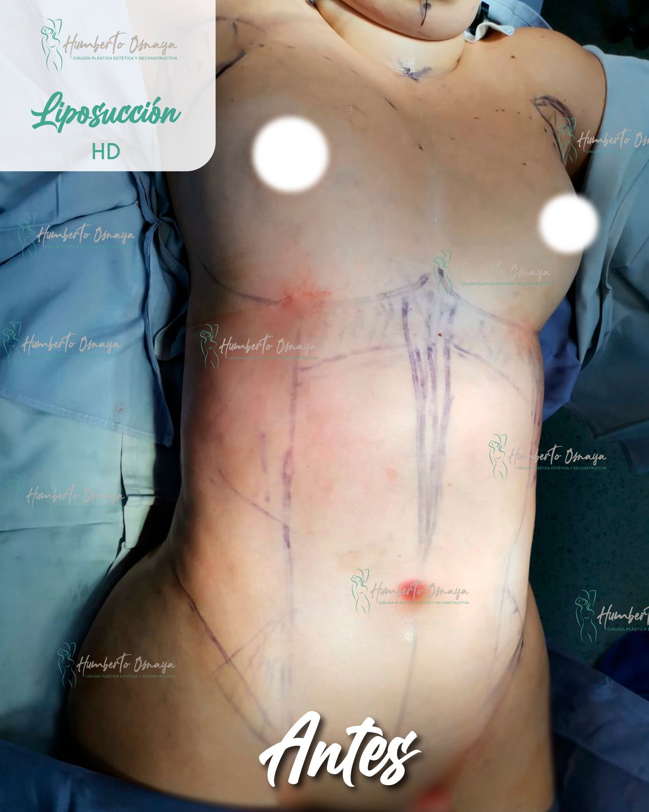 Humberto Osnaya Moreno-23