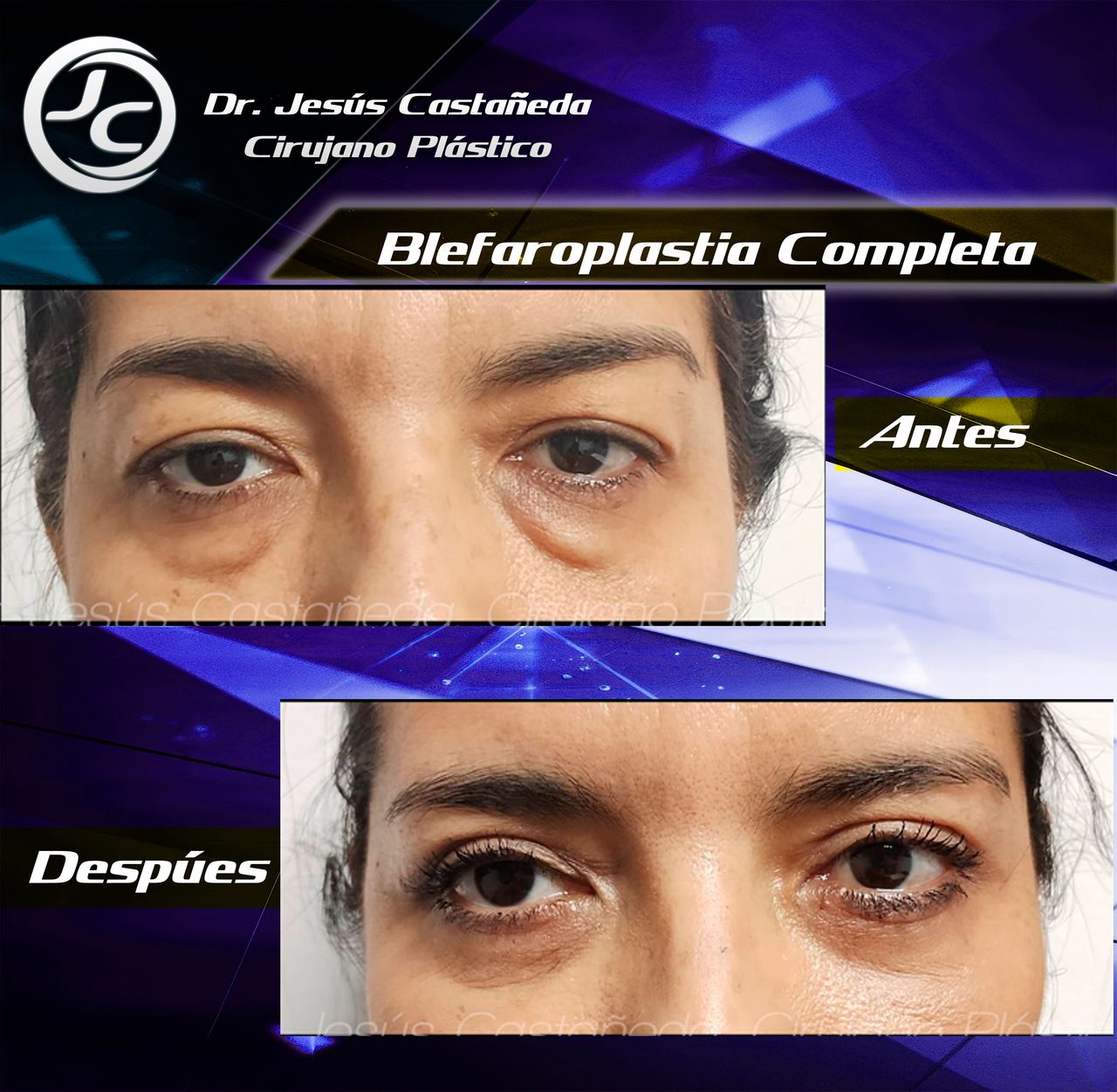 Jesús Castañeda Hernández-0