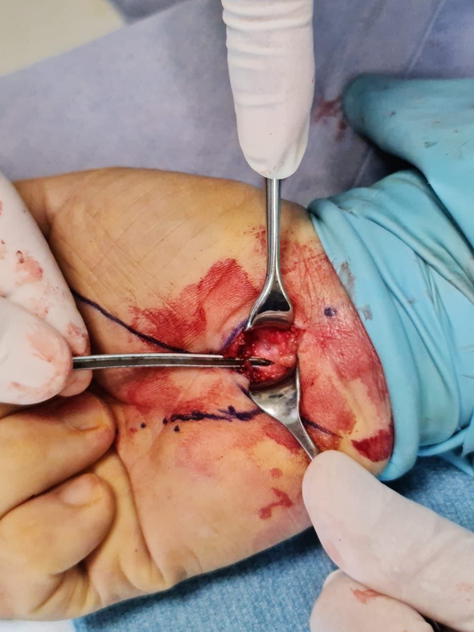 Victor Manuel Valdez Tapia-2