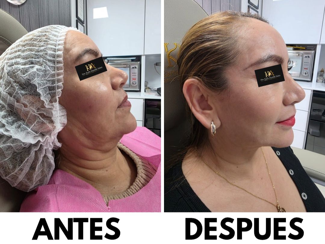 Karla Alamilla Yañez-5