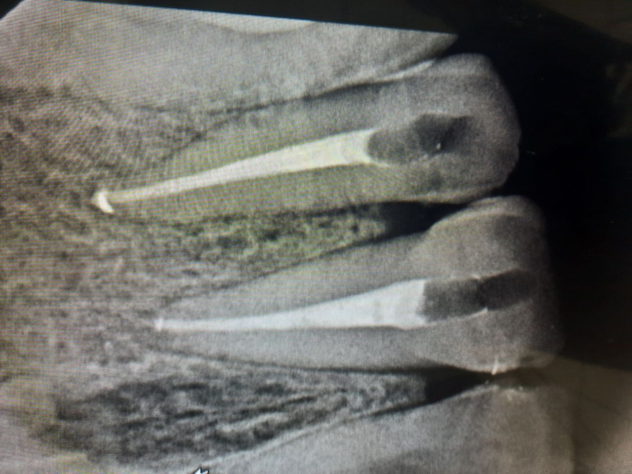 Oscar Justo Bustos-14