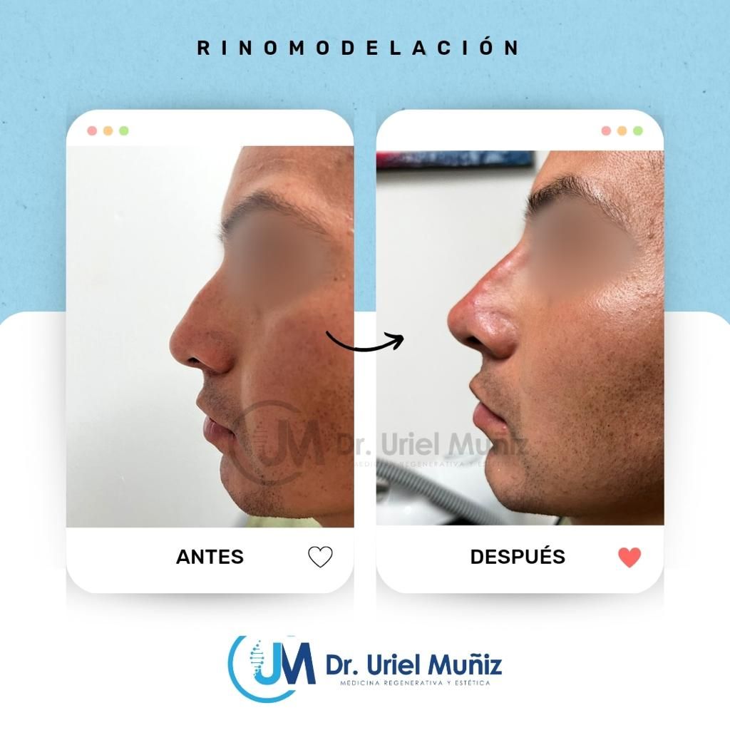 Teófilo Uriel Muñiz Chávez-25