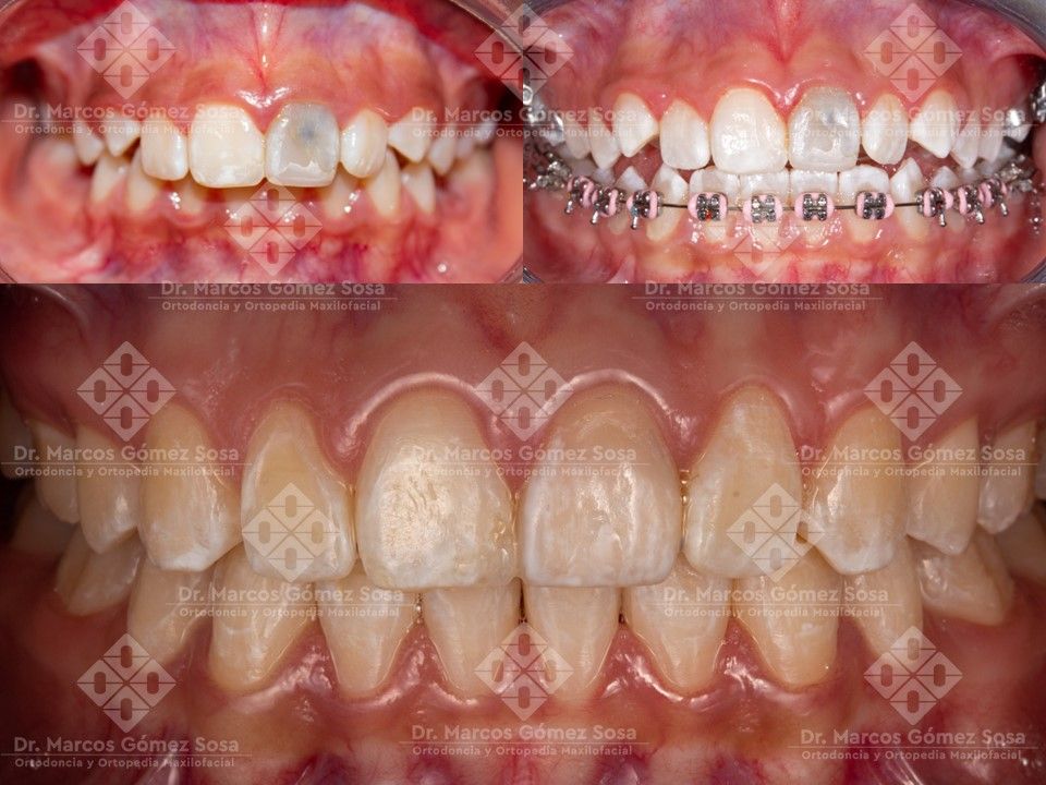 Marcos Gómez Sosa-2