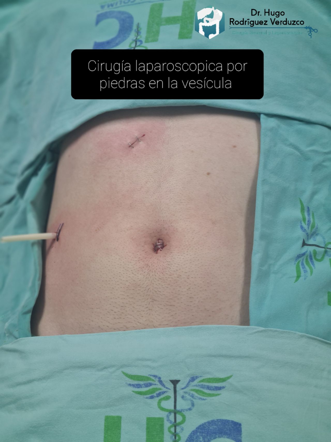 Hugo Alberto Rodríguez Verduzco-8