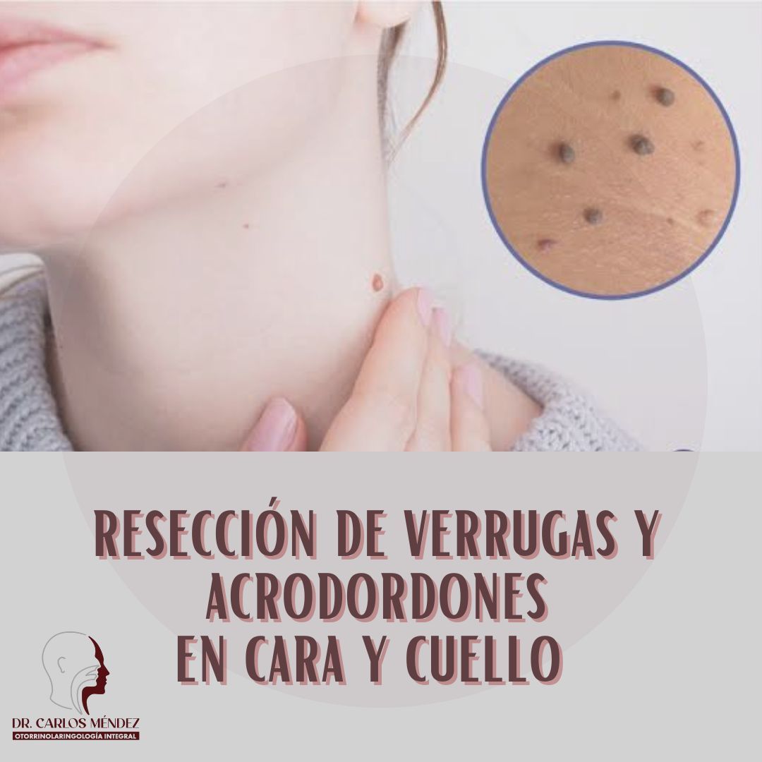 Juan Carlos Mendez Gutierrez-44