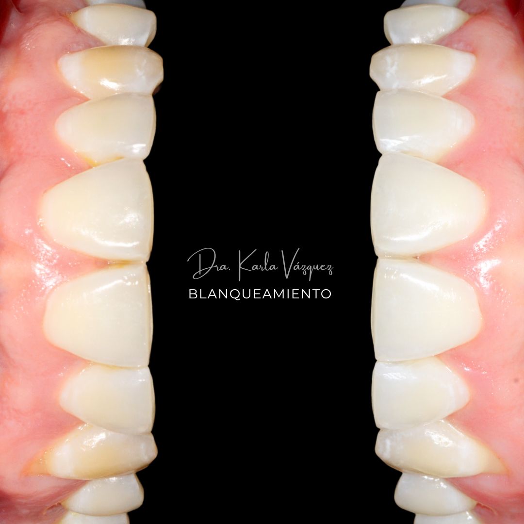 Karla Denisse Vázquez Olmedo-3