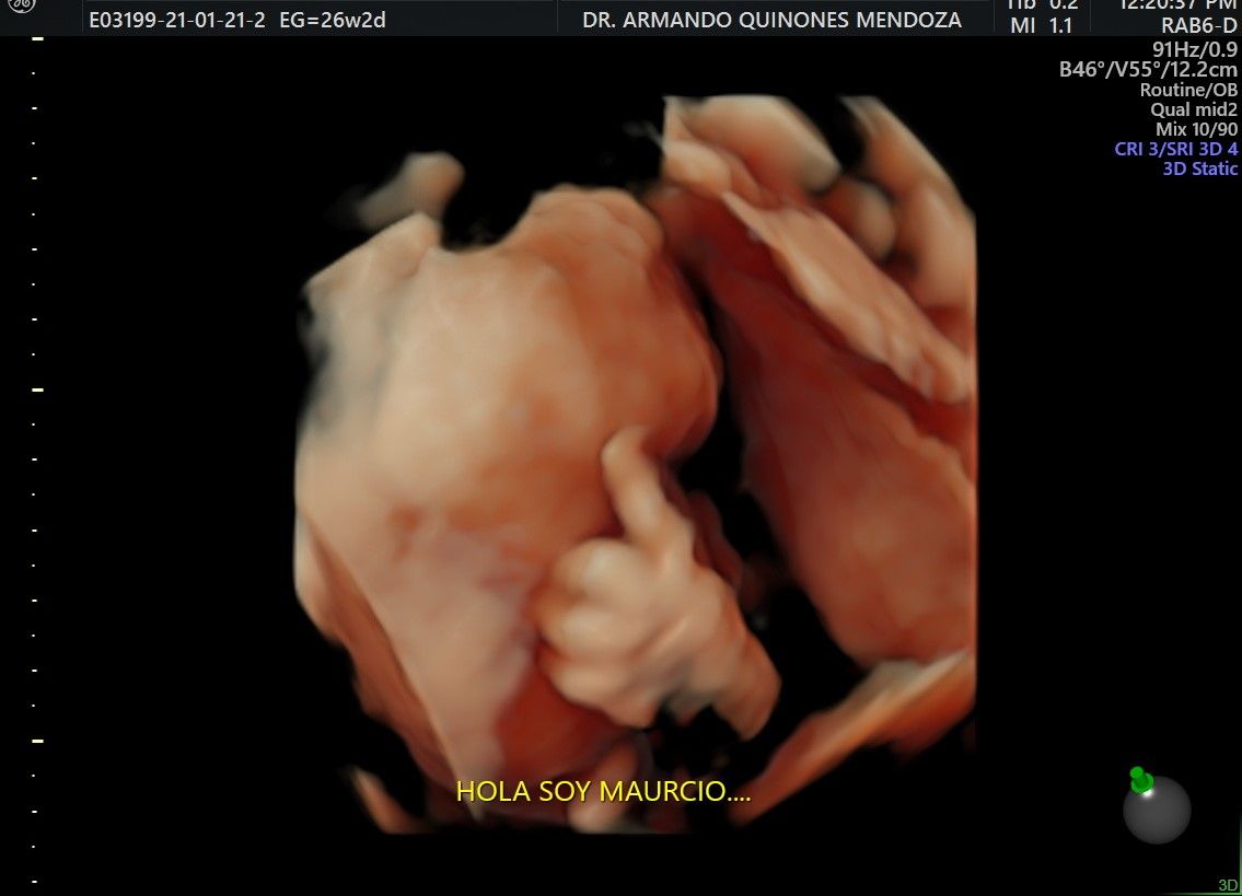 Armando Quiñones Mendoza-14