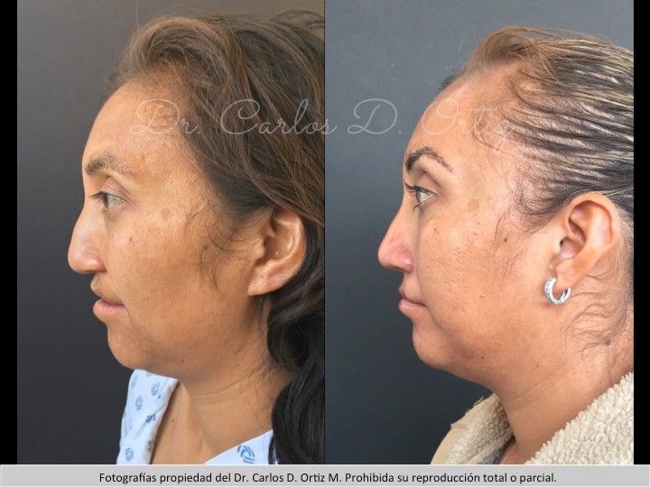 Carlos David Ortiz Moreno-64