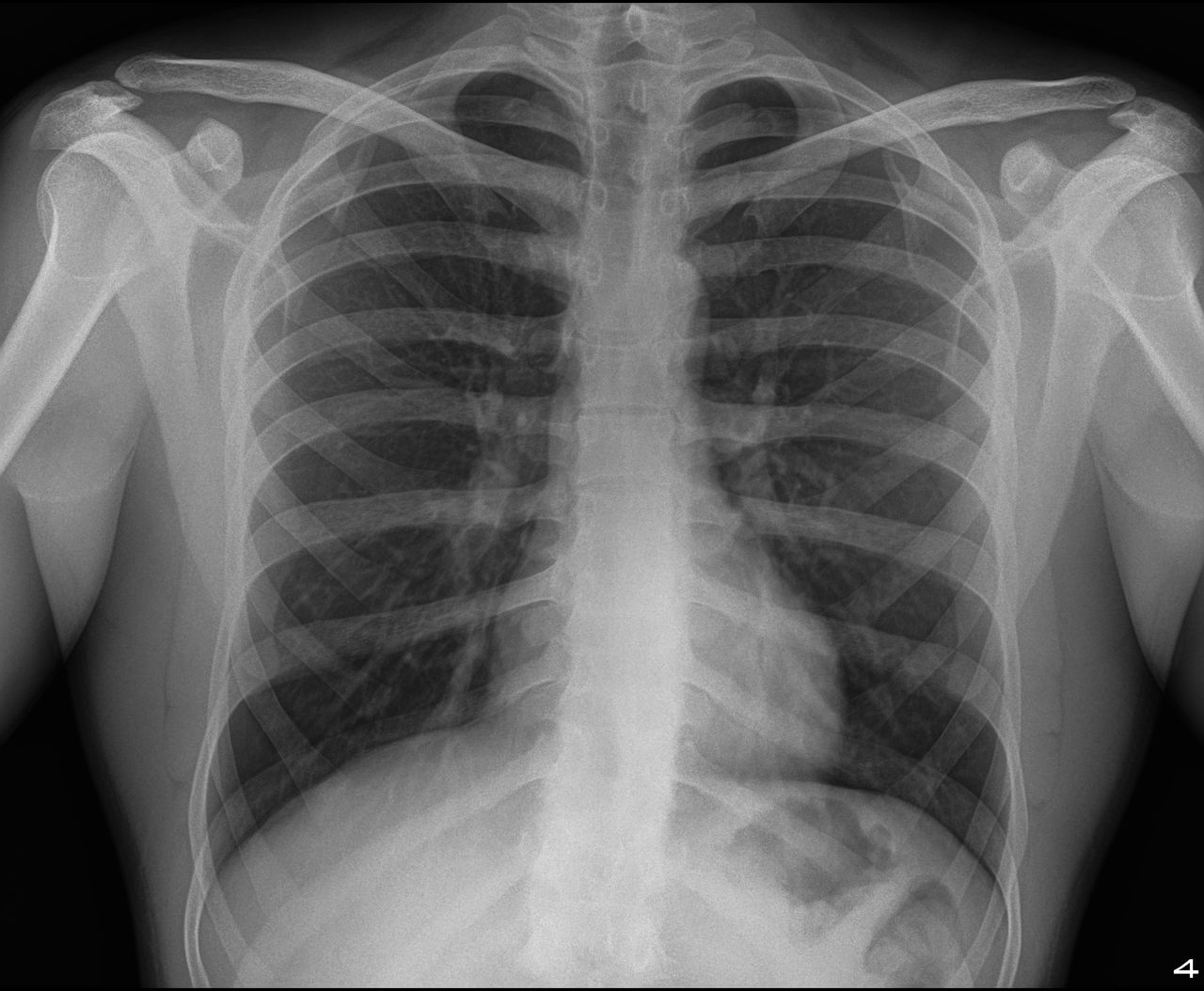 Samuel Garza Pacheco -6