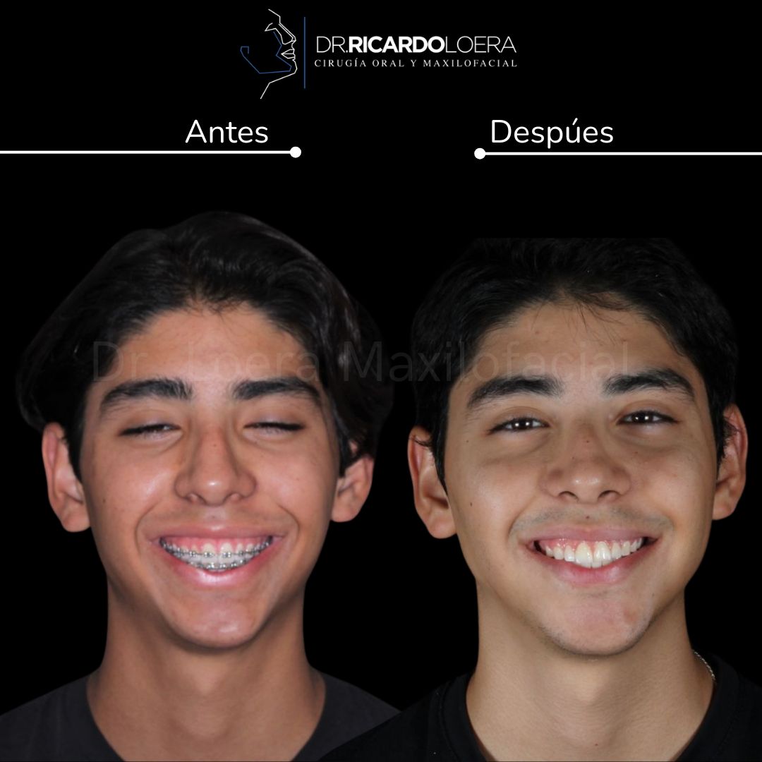 Ricardo Loera Morales-68