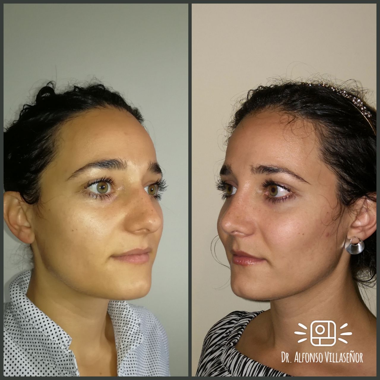 Alfonso Villaseñor Herrero-6