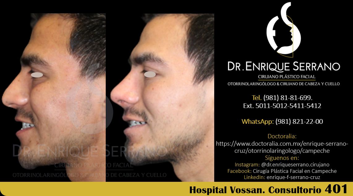 Enrique Serrano Cruz-98