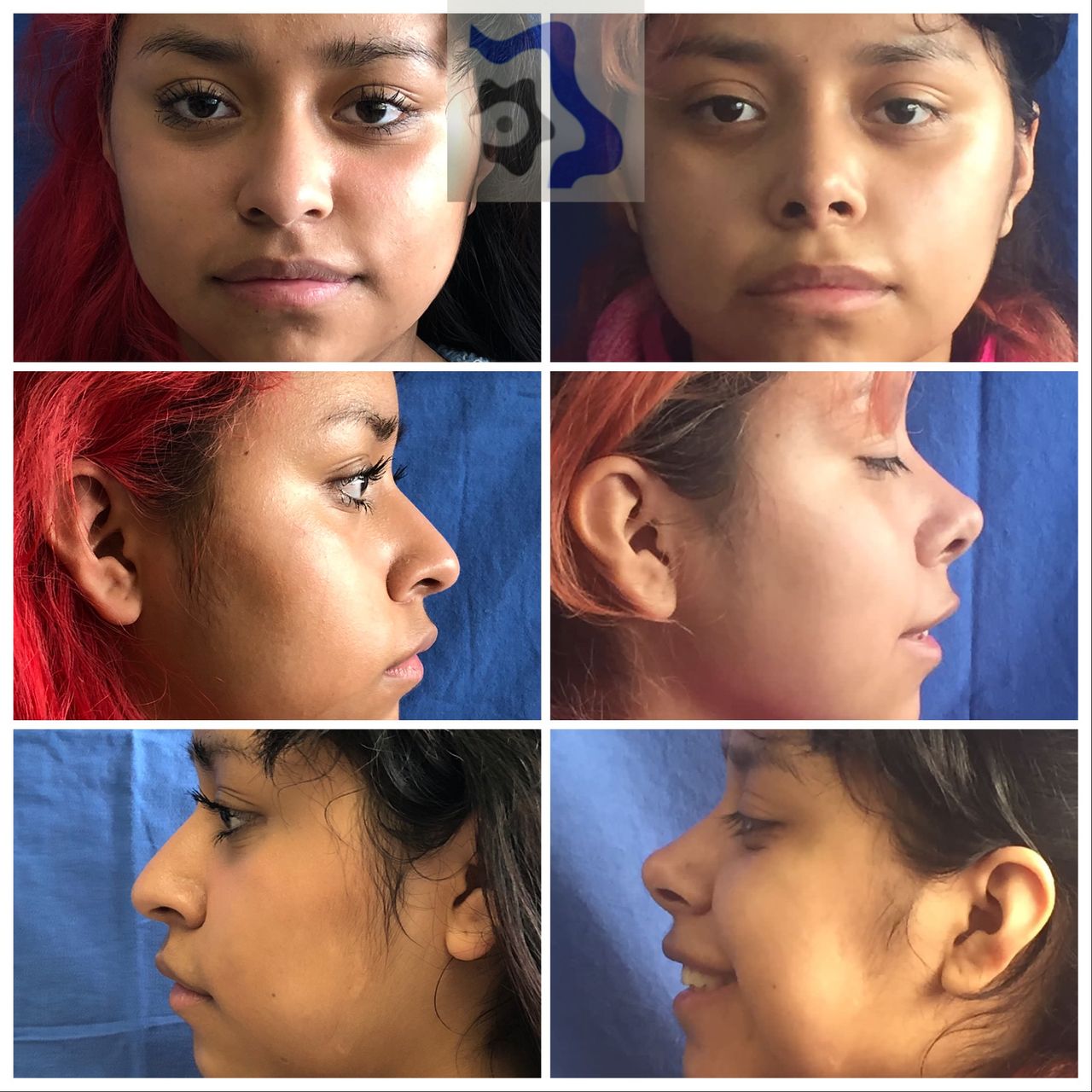 Cesar Alfonso Gutierrez Espinosa-4