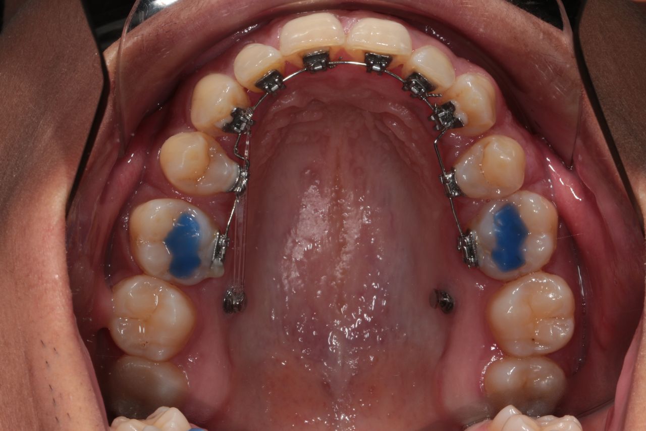 Javier Ibáñez Brambila-4